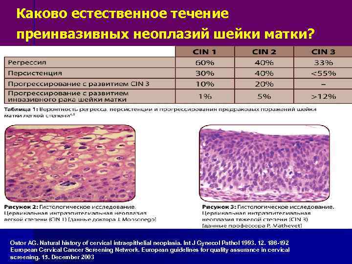 Плоскоклеточное поражение низкой степени