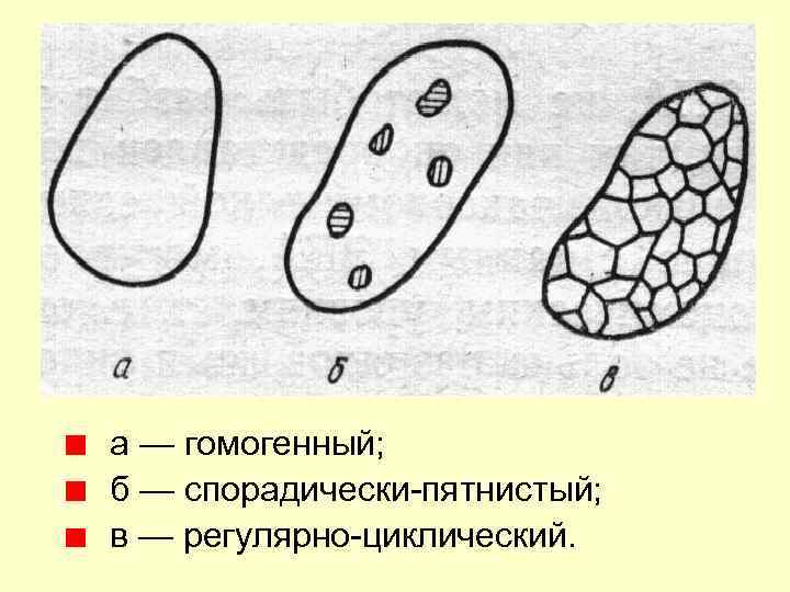 а — гомогенный; б — спорадически-пятнистый; в — регулярно-циклический. 