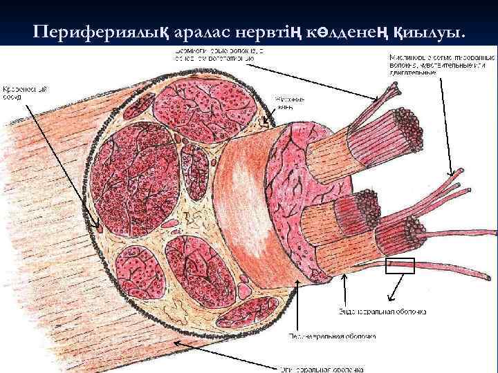 Перифериялық аралас нервтің көлденең қиылуы. 