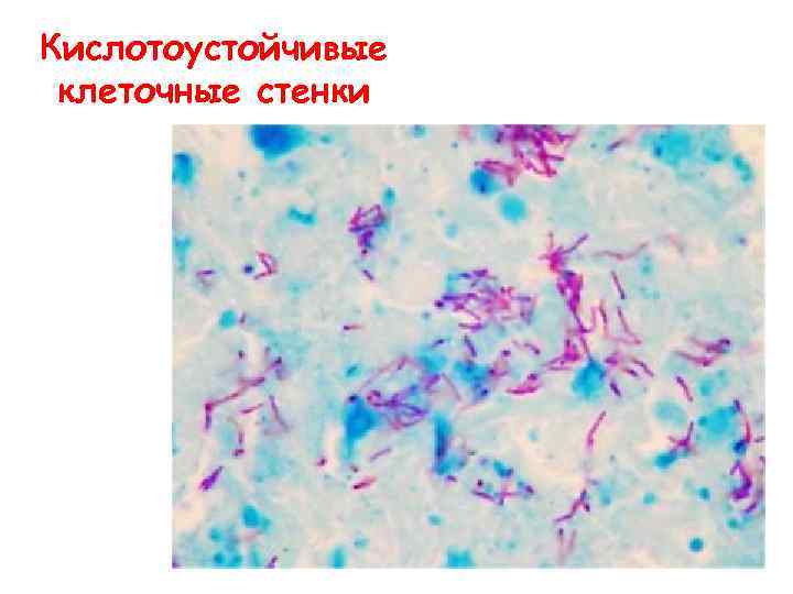 Кислотоустойчивые клеточные стенки 