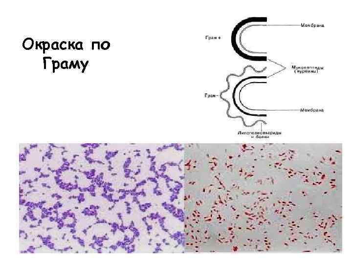 Окраска по Граму 