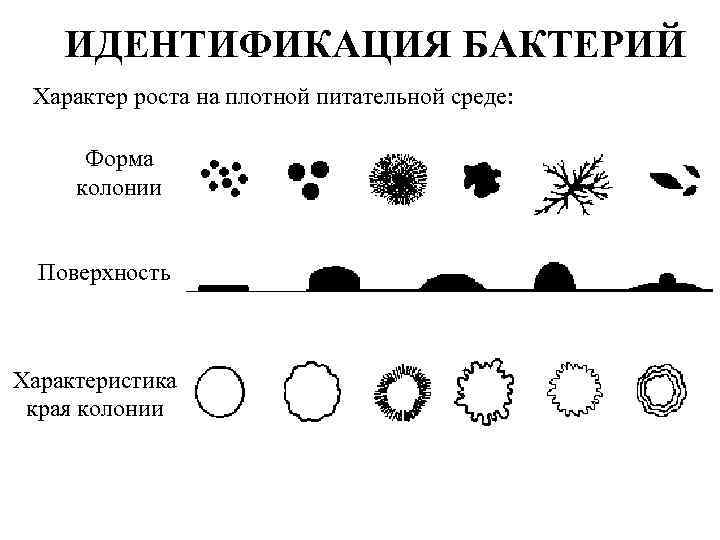 ИДЕНТИФИКАЦИЯ БАКТЕРИЙ Характер роста на плотной питательной среде: Форма колонии Поверхность Характеристика края колонии