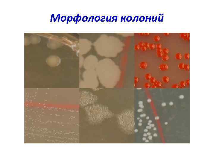Морфология колоний 