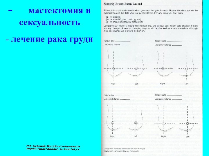 - мастектомия и сексуальность - лечение рака груди From: Our Sexuality, Third Edition, Crooks
