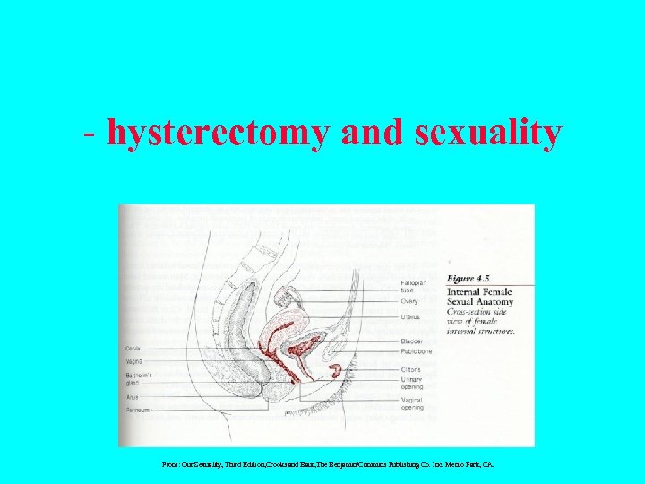 - hysterectomy and sexuality From: Our Sexuality, Third Edition, Crooks and Baur, The Benjamin/Cummins