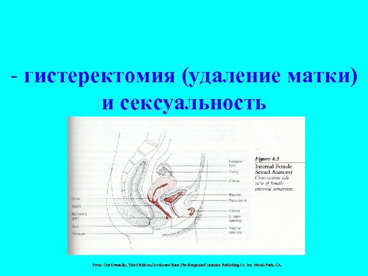 - гистеректомия (удаление матки) и сексуальность From: Our Sexuality, Third Edition, Crooks and Baur,
