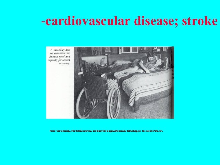-cardiovascular disease; stroke From: Our Sexuality, Third Edition, Crooks and Baur, The Benjamin/Cummins Publishing