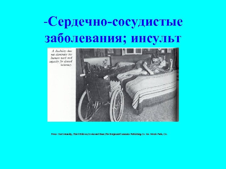 -Сердечно-сосудистые заболевания; инсульт From: Our Sexuality, Third Edition, Crooks and Baur, The Benjamin/Cummins Publishing