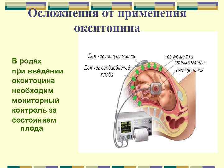 Осложнения от применения окситоцина В родах при введении окситоцина необходим мониторный контроль за состоянием