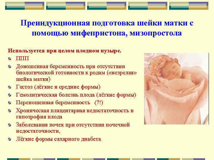 Преиндукционная подготовка шейки матки с помощью мифепристона, мизопростола Используется при целом плодном пузыре. ППП