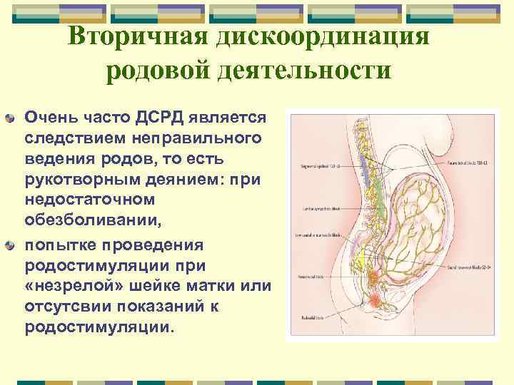 Вторичная дискоординация родовой деятельности Очень часто ДСРД является следствием неправильного ведения родов, то есть