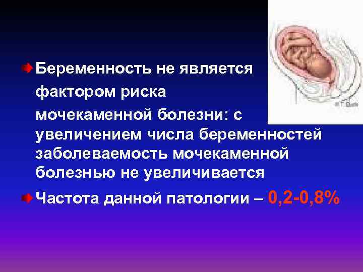 Беременность не является фактором риска мочекаменной болезни: с увеличением числа беременностей заболеваемость мочекаменной болезнью