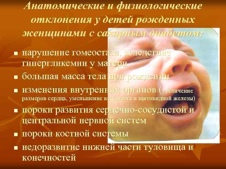 Анатомические и физиологические отклонения у детей рожденных женщинами с сахарным диабетом: n n n