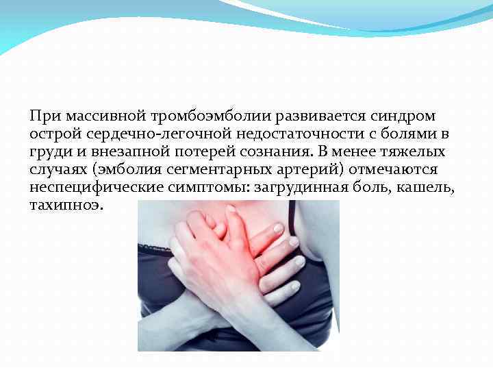 При массивной тромбоэмболии развивается синдром острой сердечно легочной недостаточности с болями в груди и