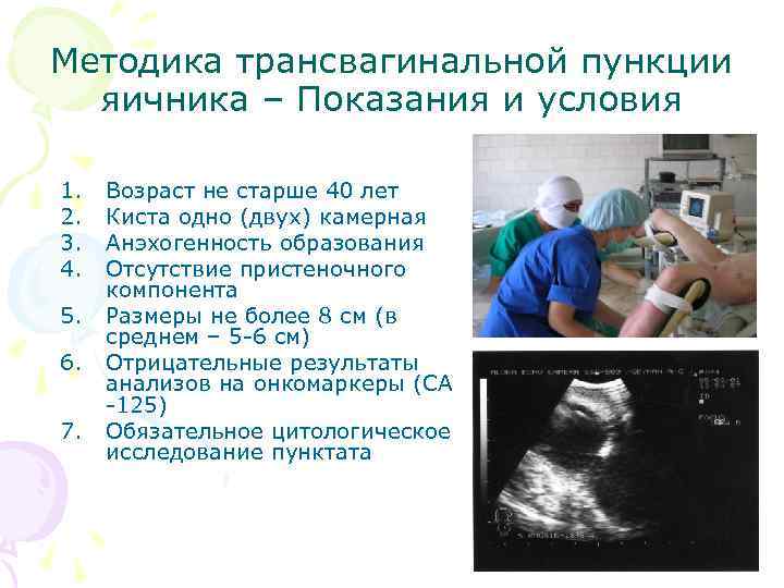 Методика трансвагинальной пункции яичника – Показания и условия 1. 2. 3. 4. 5. 6.