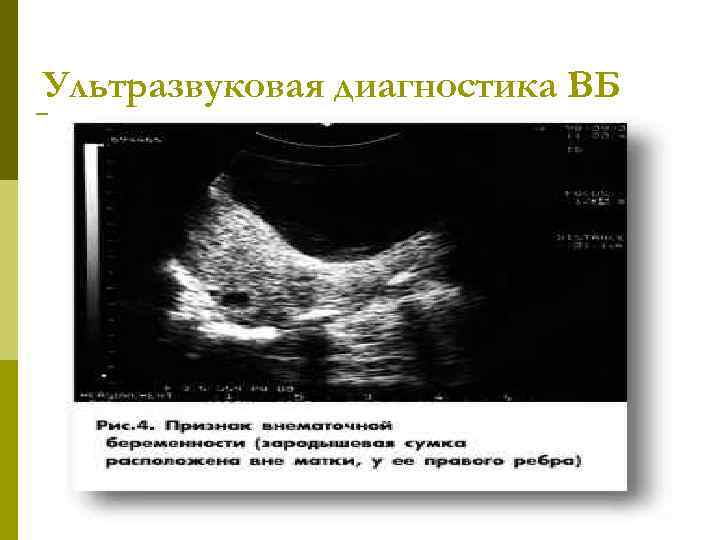 Ультразвуковая диагностика ВБ 