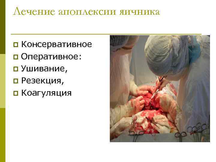 Лечение апоплексии яичника Консервативное p Оперативное: p Ушивание, p Резекция, p Коагуляция p 