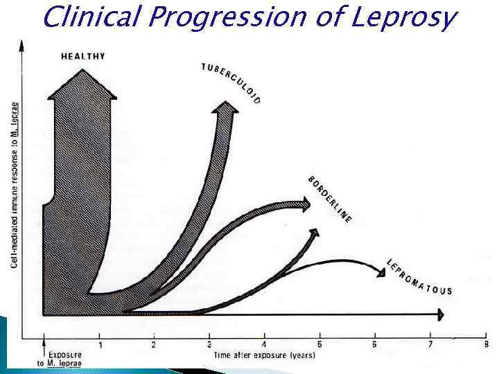 Clinical Progression of Leprosy 