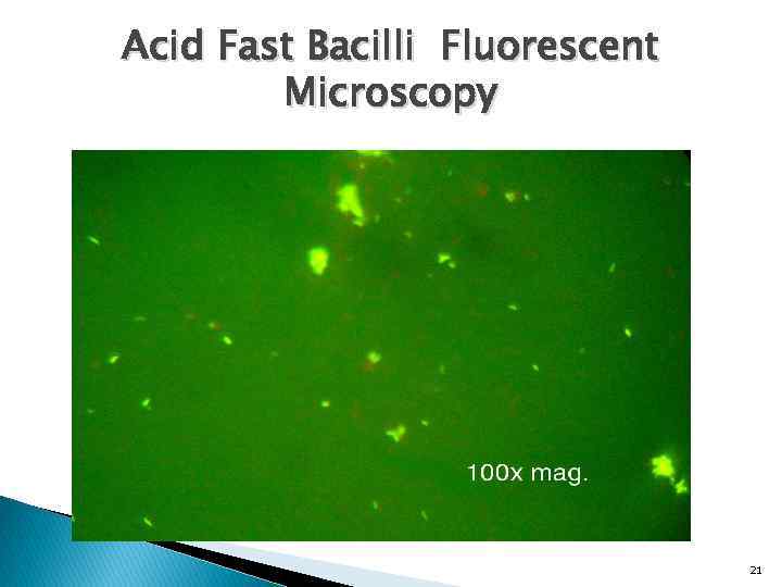 Acid Fast Bacilli Fluorescent Microscopy 21 