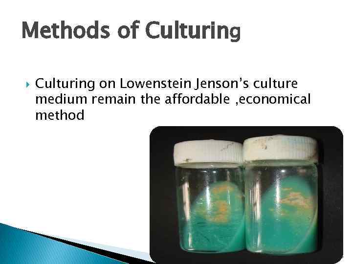 Methods of Culturing on Lowenstein Jenson’s culture medium remain the affordable , economical method