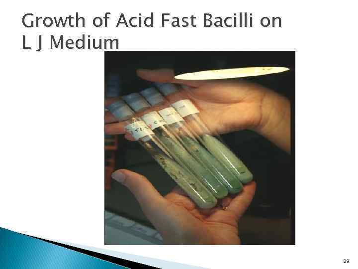 Growth of Acid Fast Bacilli on L J Medium 29 