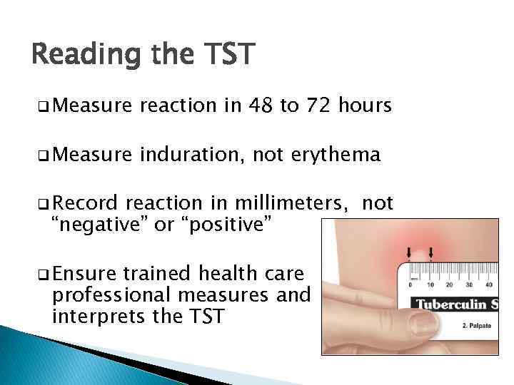 Reading the TST q Measure reaction in 48 to 72 hours q Measure induration,