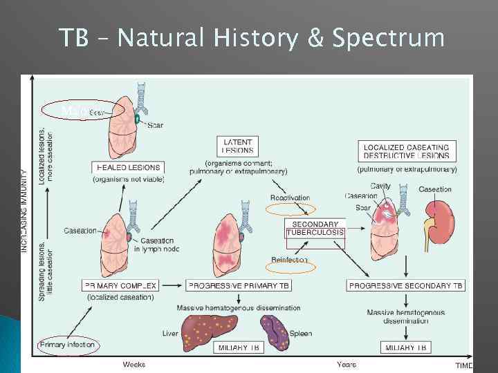 TB – Natural History & Spectrum Majority 