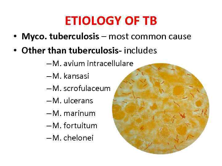 ETIOLOGY OF TB • Myco. tuberculosis – most common cause • Other than tuberculosis-