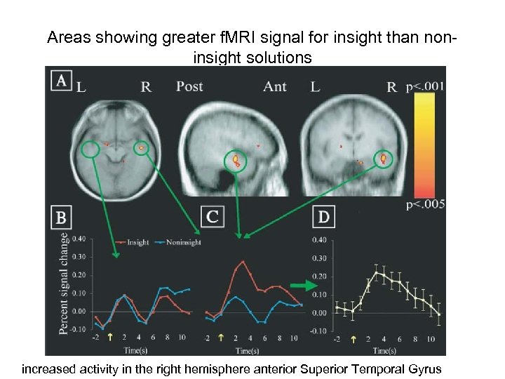 Areas showing greater f. MRI signal for insight than noninsight solutions increased activity in