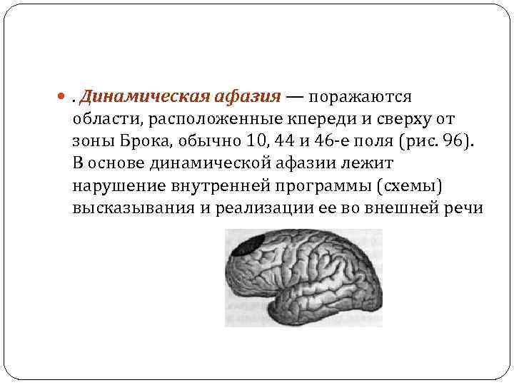  . Динамическая афазия — поражаются области, расположенные кпереди и сверху от зоны Брока,