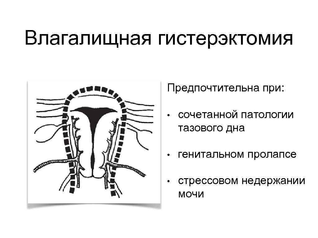 Субтотальная гистерэктомия презентация