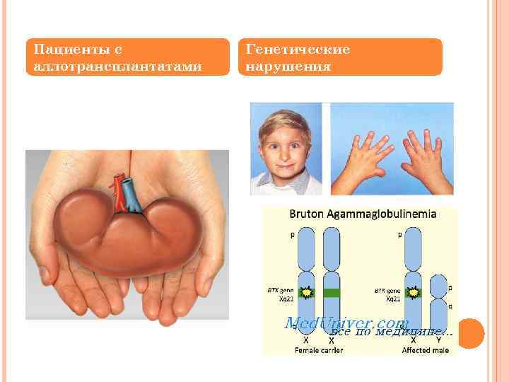 Пациенты с аллотрансплантатами Генетические нарушения 