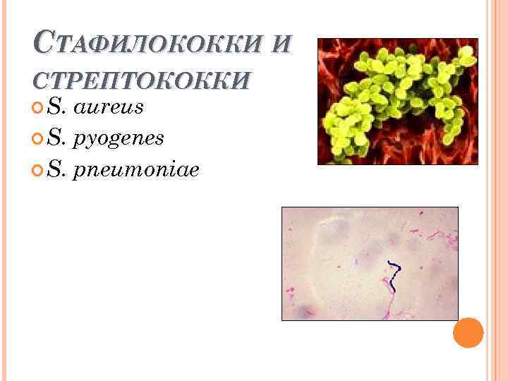 СТАФИЛОКОККИ И СТРЕПТОКОККИ S. aureus S. pyogenes S. pneumoniae 