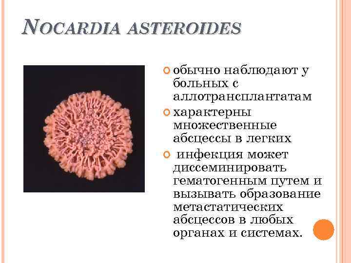 NOCARDIA ASTEROIDES обычно наблюдают у больных с аллотрансплантатам характерны множественные абсцессы в легких инфекция