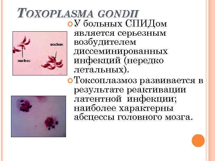 TOXOPLASMA GONDII У больных СПИДом является серьезным возбудителем диссеминированных инфекций (нередко летальных). Токсоплазмоз развивается