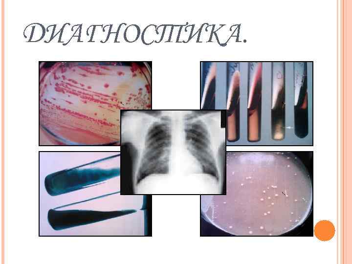 ДИАГНОСТИКА. 