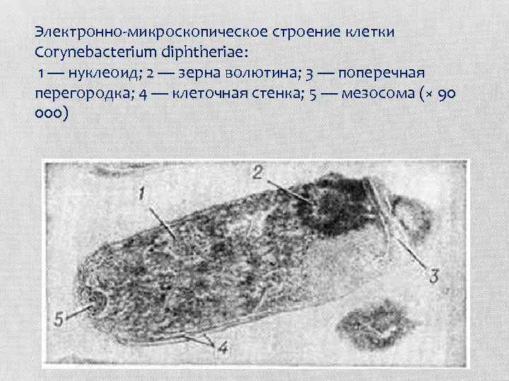 Электронно-микроскопическое строение клетки Corynebacterium diphtheriae: 1 — нуклеоид; 2 — зерна волютина; 3 —