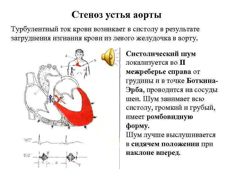 Неполное сердце