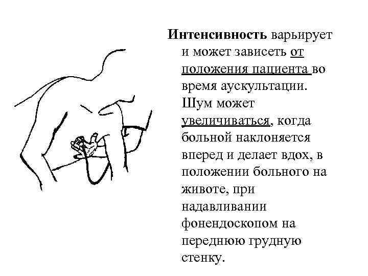 Интенсивность варьирует и может зависеть от положения пациента во время аускультации. Шум может увеличиваться,