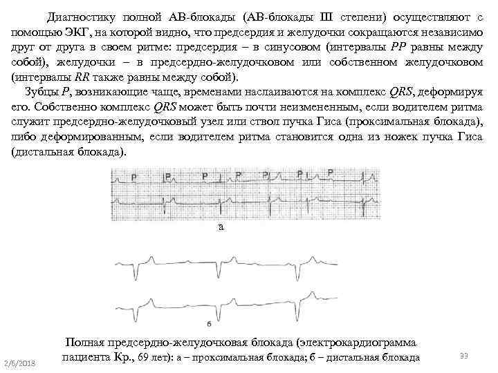 Полная блокада левой ножки карта вызова