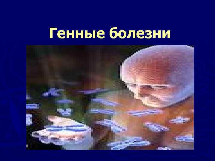 Генные болезни 