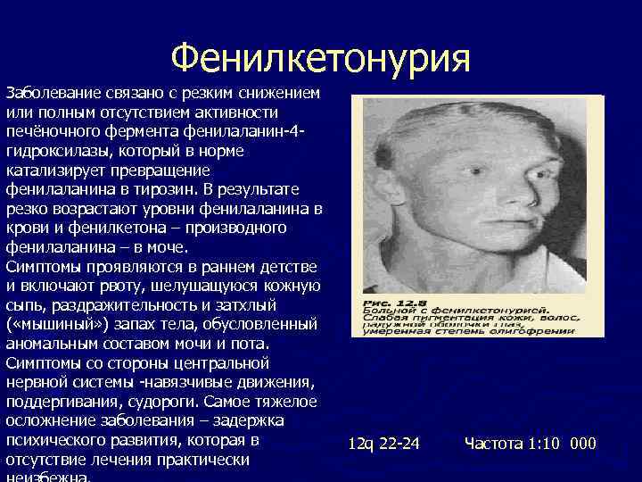 Фенилкетонурия Заболевание связано с резким снижением или полным отсутствием активности печёночного фермента фенилаланин-4 гидроксилазы,