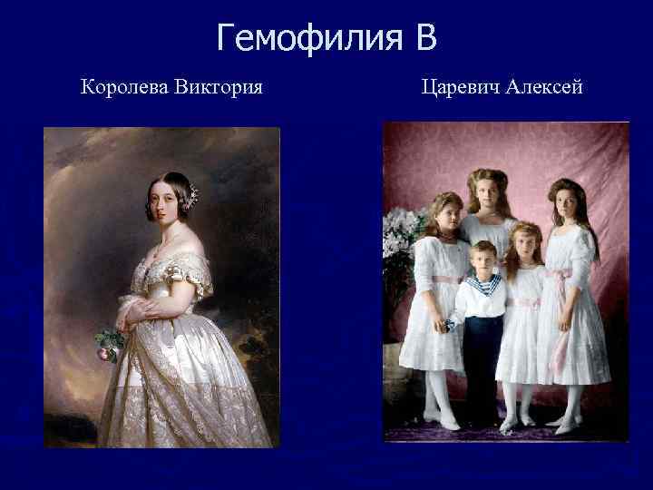 Гемофилия В Королева Виктория Царевич Алексей 