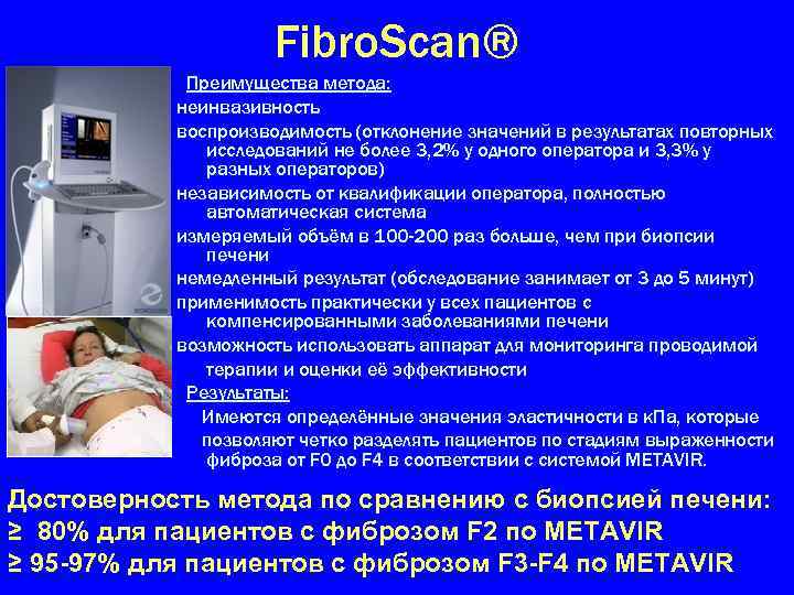 Fibro. Scan® Преимущества метода: неинвазивность воспроизводимость (отклонение значений в результатах повторных исследований не более
