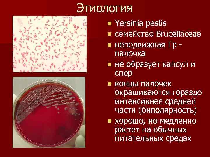 Этиология n n n Yersinia pestis семейство Brucellaceae неподвижная Гр палочка не образует капсул