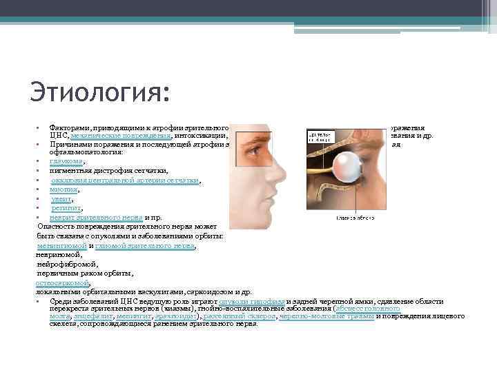 Этиология: • Факторами, приводящими к атрофии зрительного нерва, могут выступать заболевания глаза, поражения ЦНС,