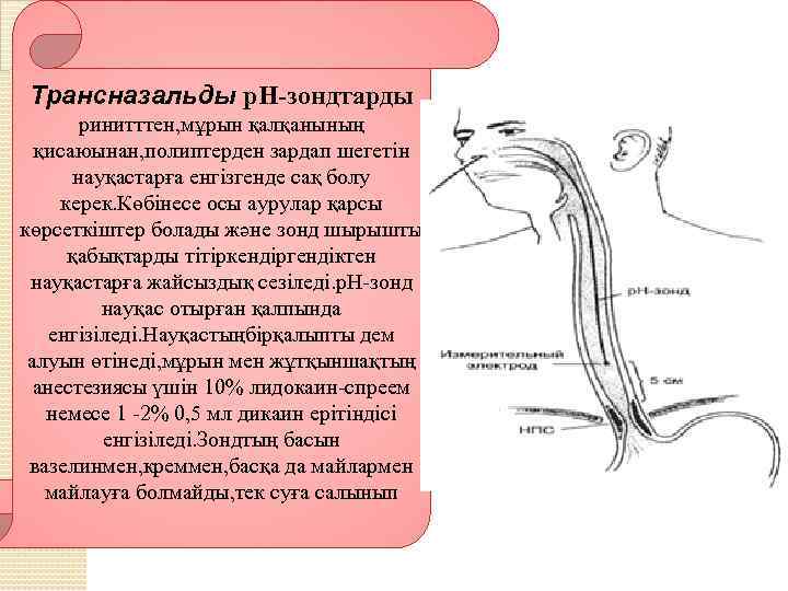 Трансназальды р. Н-зондтарды ринитттен, мұрын қалқанының қисаюынан, полиптерден зардап шегетін науқастарға енгізгенде сақ болу