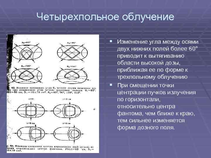 Четырехпольное облучение § Изменение угла между осями двух нижних полей более 60° приводит к