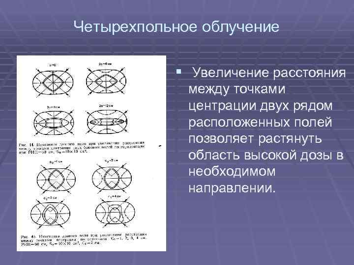 Четырехпольное облучение § Увеличение расстояния между точками центрации двух рядом расположенных полей позволяет растянуть
