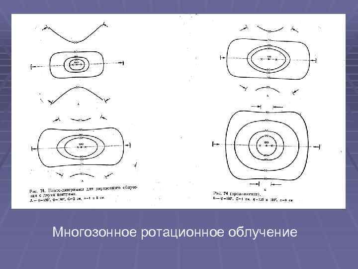 Многозонное ротационное олучение Многозонное ротационное облучение 